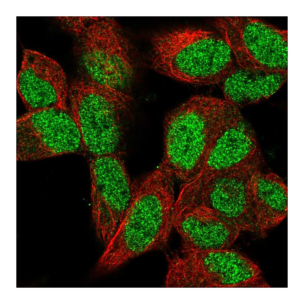 Atlas Antibodies Anti-PCGF2 Antibody