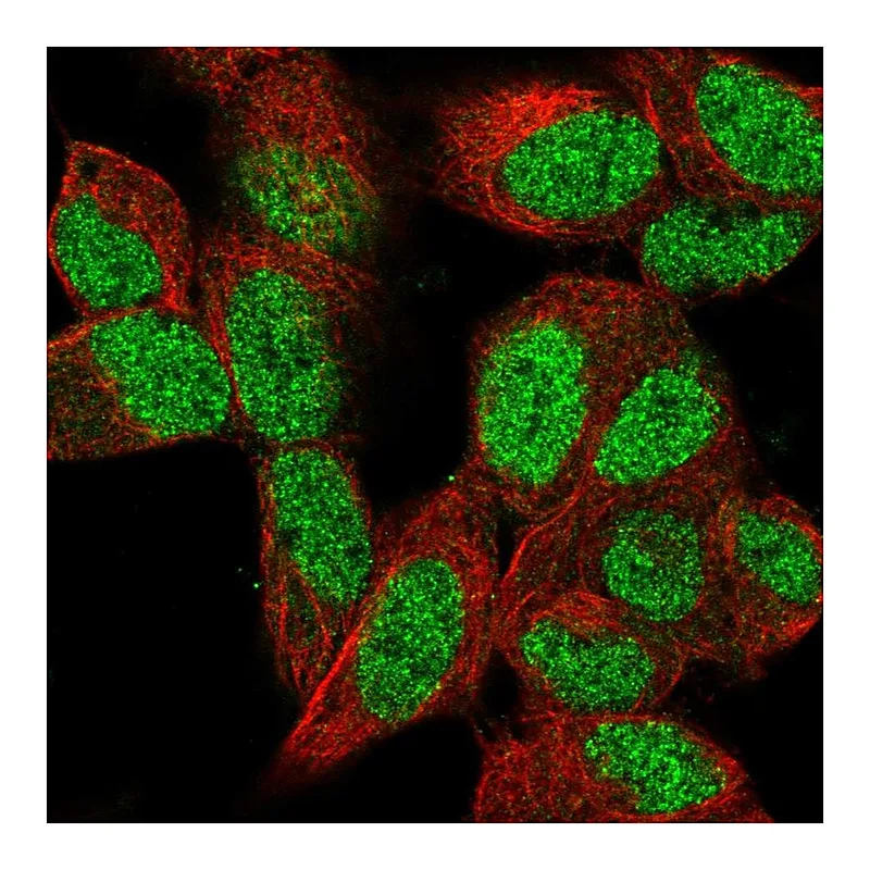 Atlas Antibodies Anti-PCGF2 Antibody