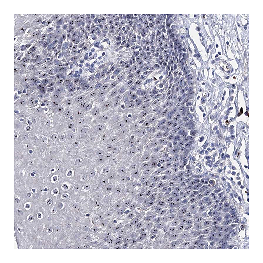 Atlas Antibodies Anti-PCGF5 Antibody
