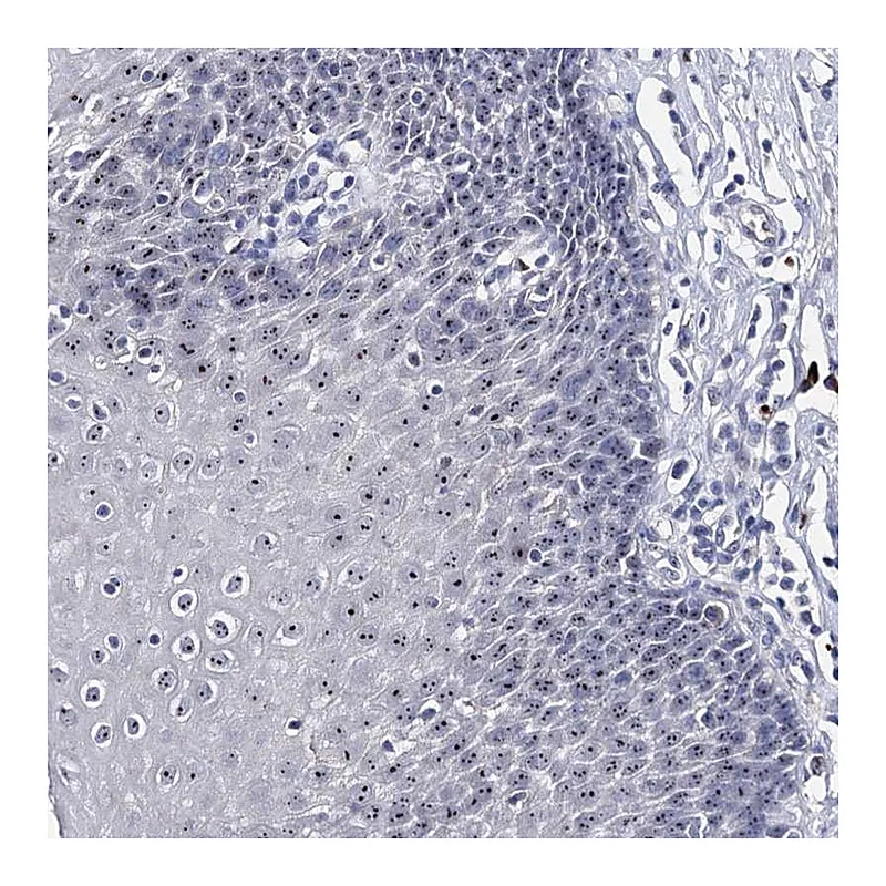 Atlas Antibodies Anti-PCGF5 Antibody