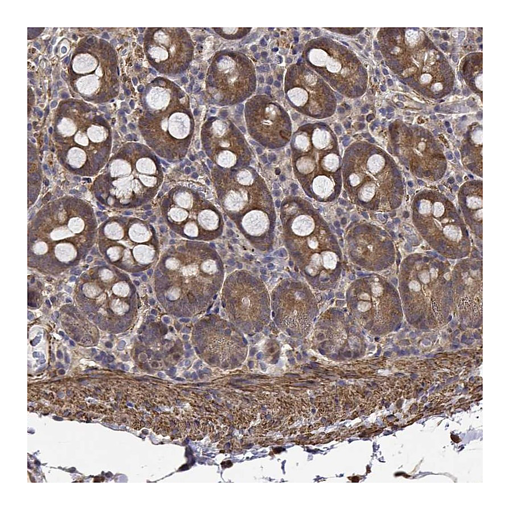 Atlas Antibodies Anti-PCID2 Antibody