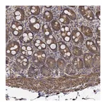 Atlas Antibodies Anti-PCID2 Antibody