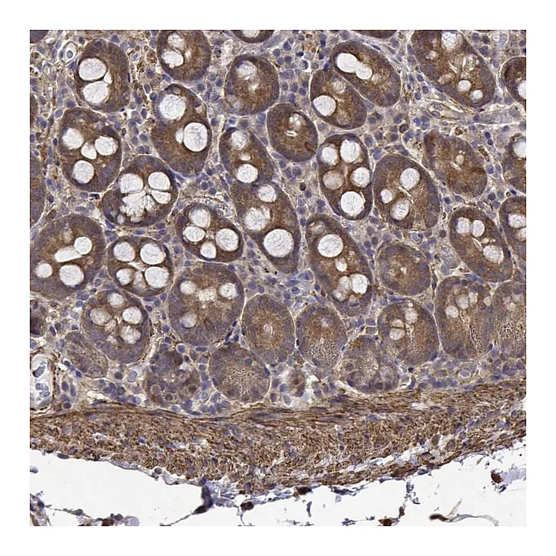 Atlas Antibodies Anti-PCID2 Antibody