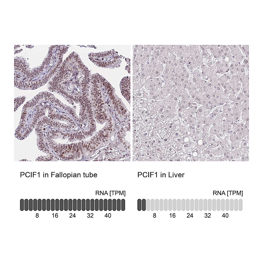 Atlas Antibodies Anti-PCIF1 Antibody