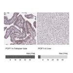 Atlas Antibodies Anti-PCIF1 Antibody