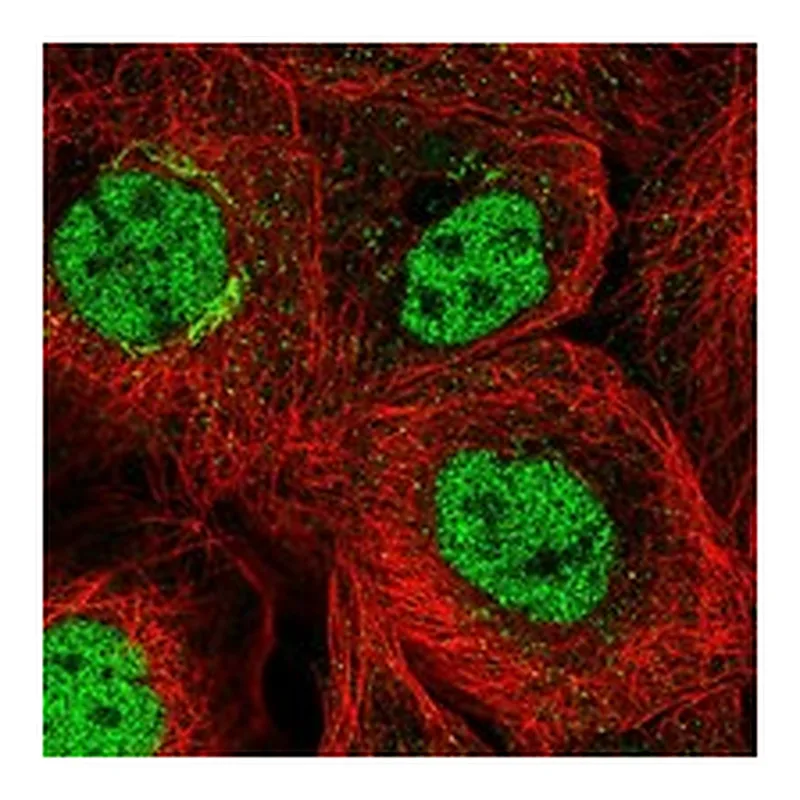 Atlas Antibodies Anti-PCGF5 Antibody