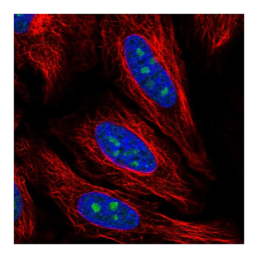 Atlas Antibodies Anti-PCID2 Antibody