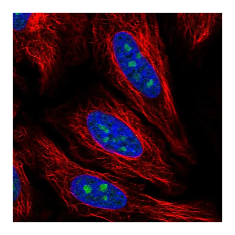 Atlas Antibodies Anti-PCID2 Antibody