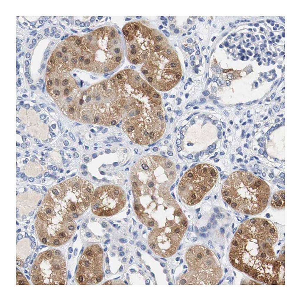 Atlas Antibodies Anti-PCK1 Antibody