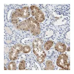 Atlas Antibodies Anti-PCK1 Antibody