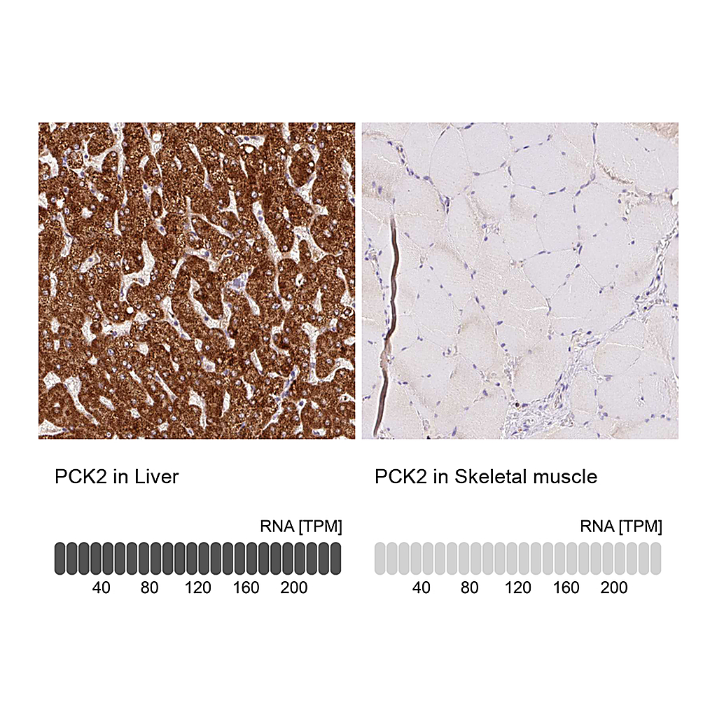Atlas Antibodies Anti-PCK2 Antibody