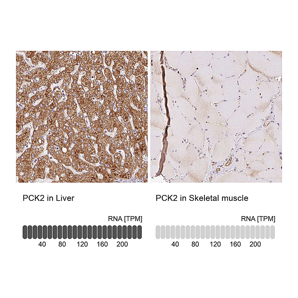 Atlas Antibodies Anti-PCK2 Antibody