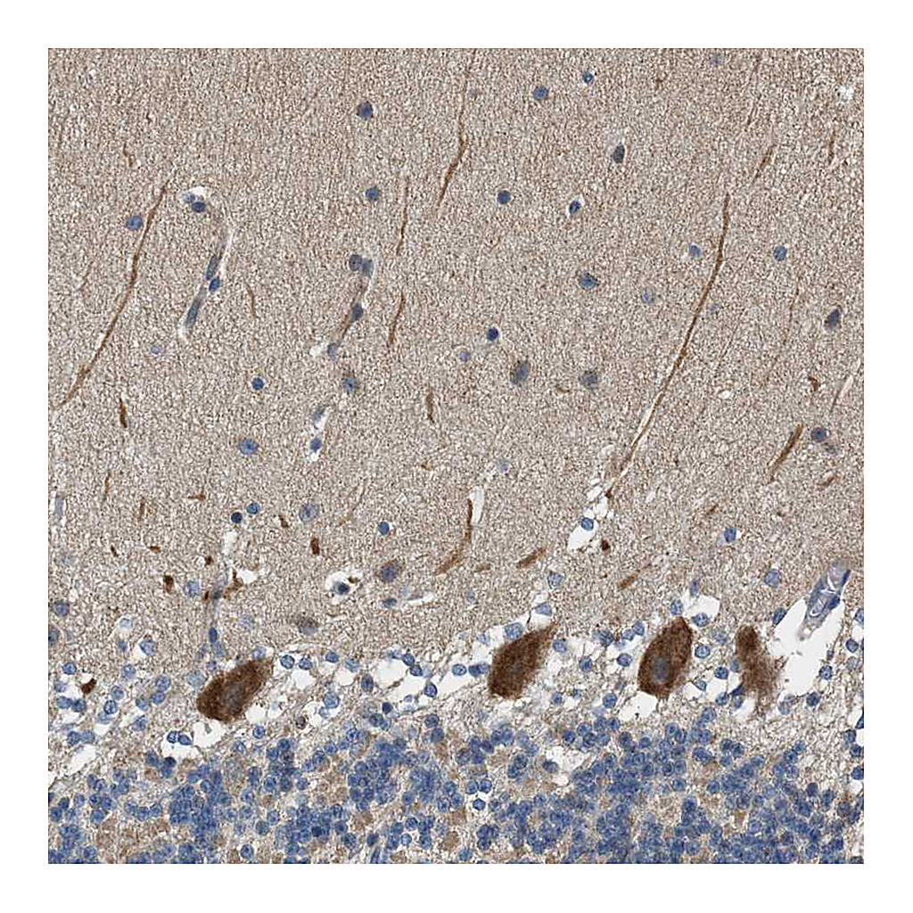 Atlas Antibodies Anti-PCLO Antibody