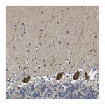 Atlas Antibodies Anti-PCLO Antibody