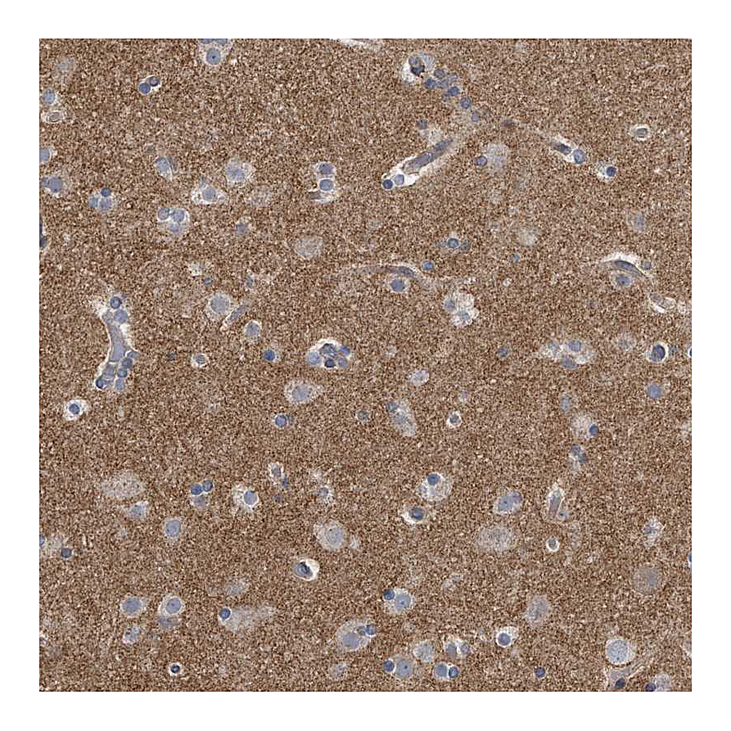 Atlas Antibodies Anti-PCLO Antibody