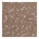 Atlas Antibodies Anti-PCLO Antibody