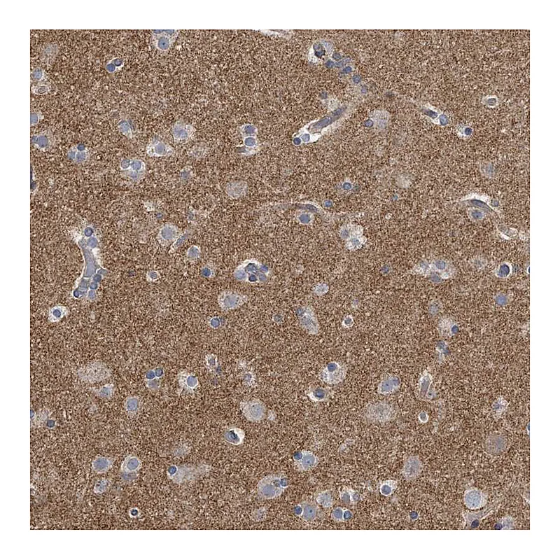 Atlas Antibodies Anti-PCLO Antibody