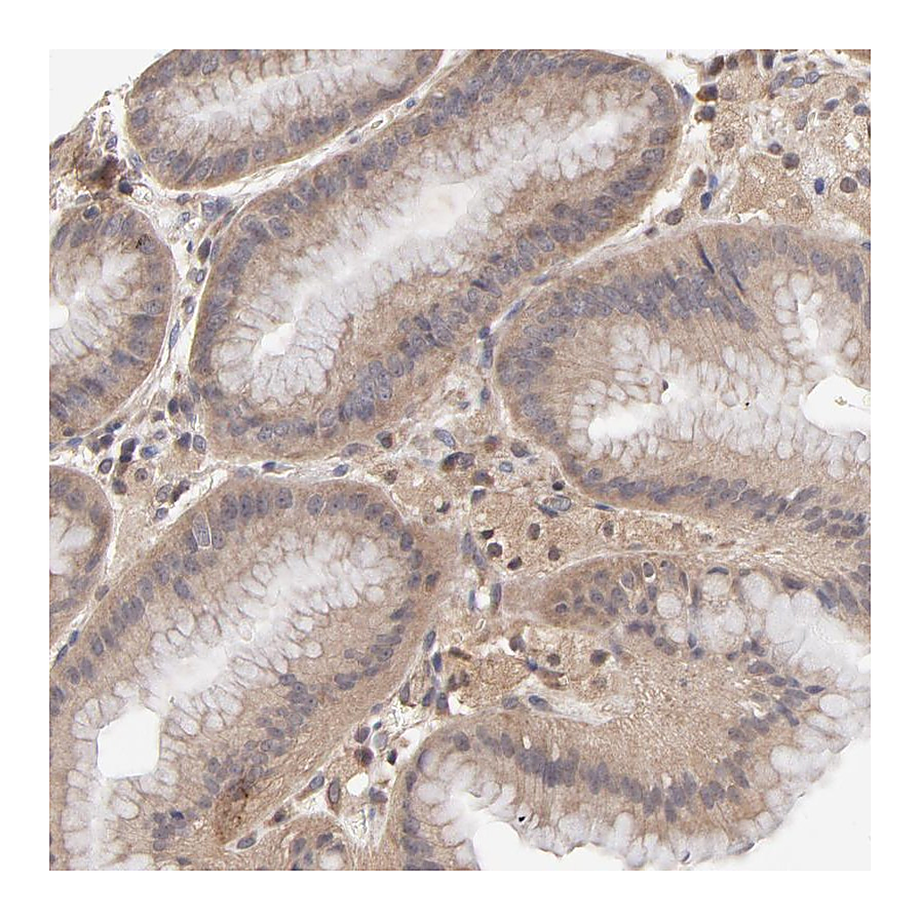 Atlas Antibodies Anti-PCMT1 Antibody