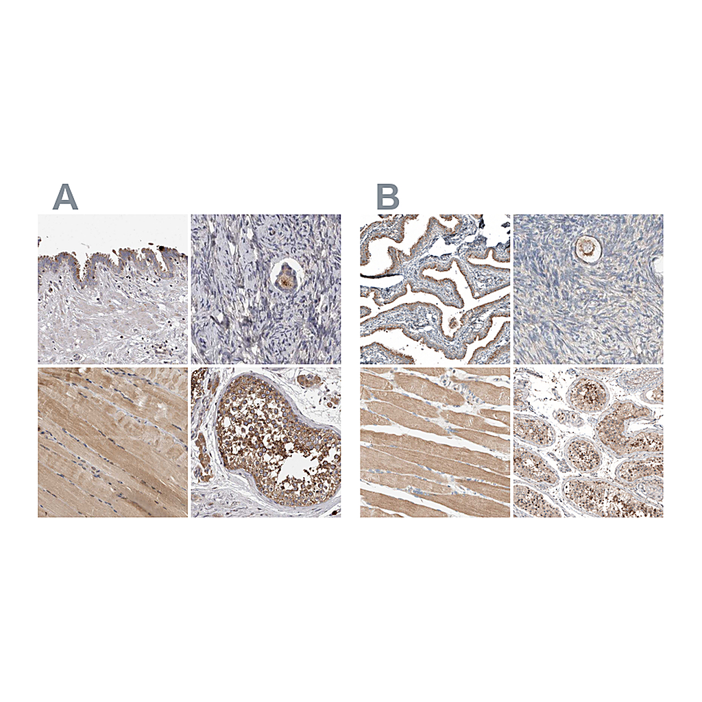 Atlas Antibodies Anti-PCM1 Antibody