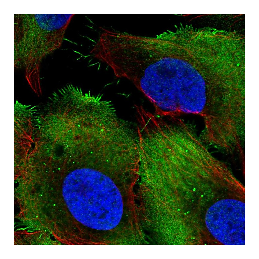 Atlas Antibodies Anti-PCMTD1 Antibody