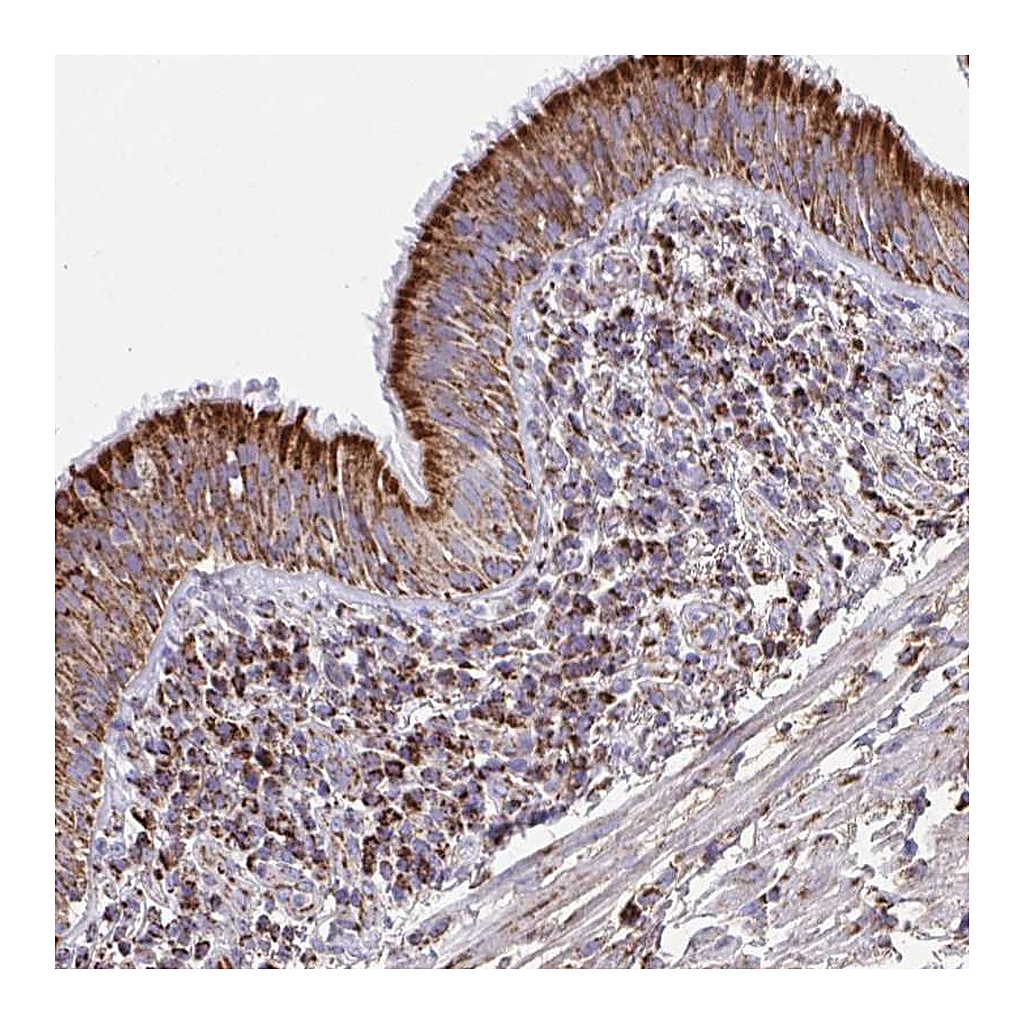 Atlas Antibodies Anti-PCMTD2 Antibody