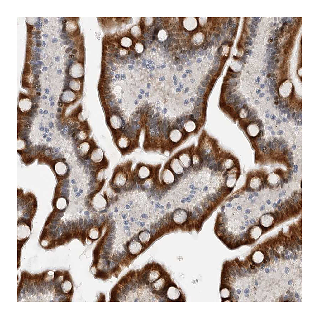 Atlas Antibodies Anti-PCMTD1 Antibody