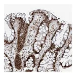 Atlas Antibodies Anti-PCNP Antibody