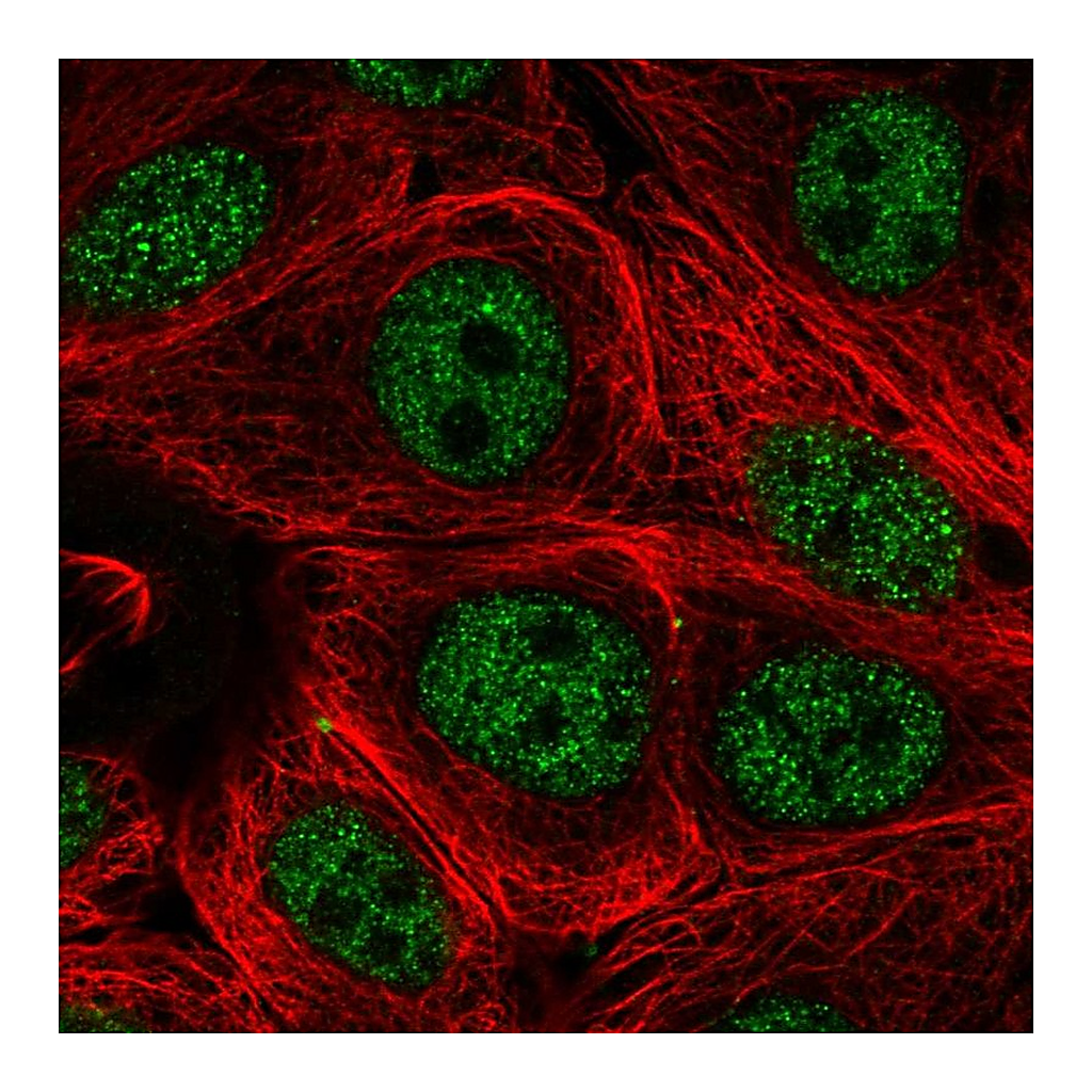 Atlas Antibodies Anti-PCNX1 Antibody