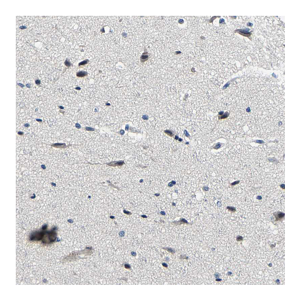 Atlas Antibodies Anti-PCNX2 Antibody