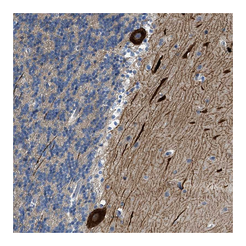 Atlas Antibodies Anti-PCNX3 Antibody