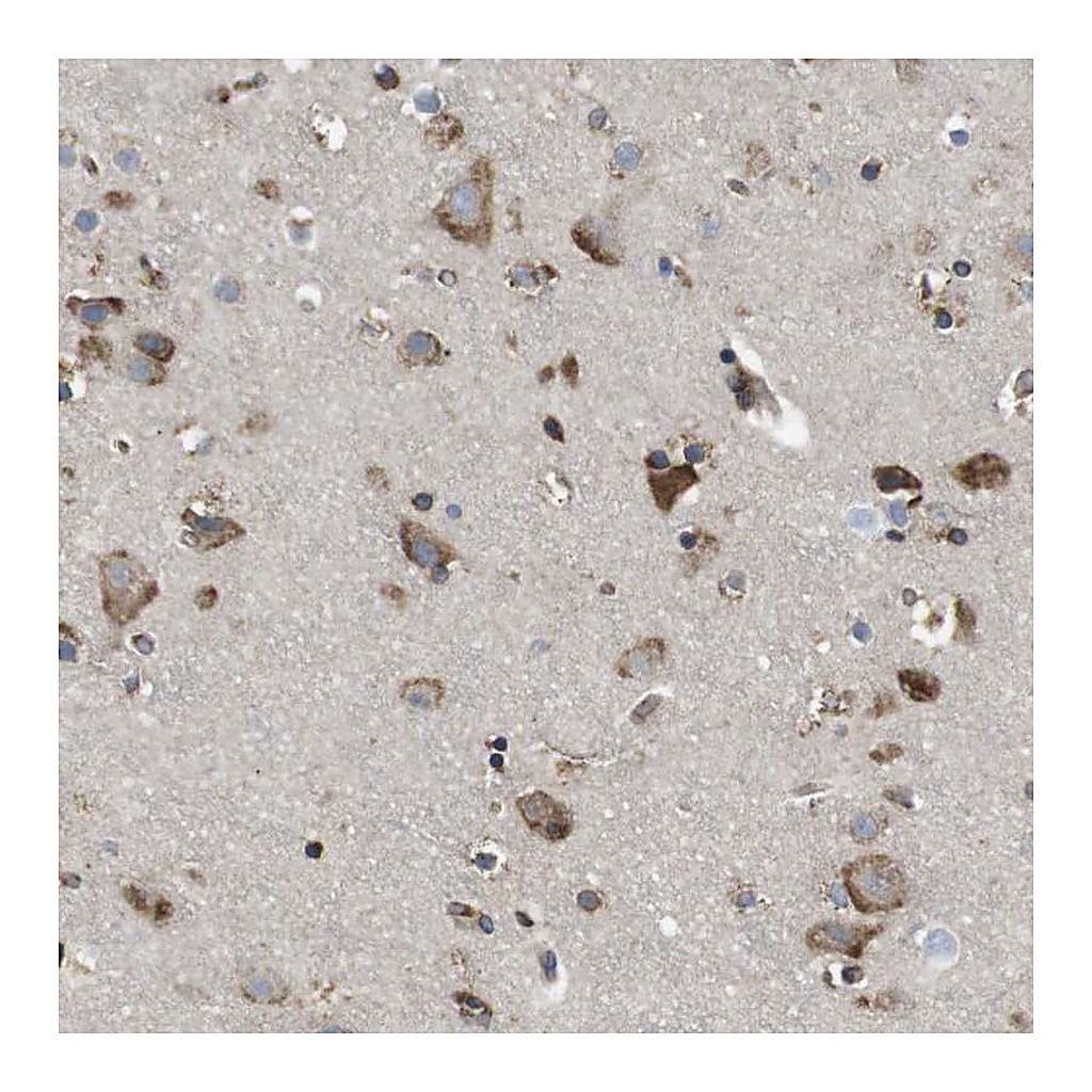 Atlas Antibodies Anti-PCNX2 Antibody