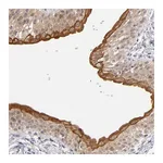 Atlas Antibodies Anti-PCNX4 Antibody