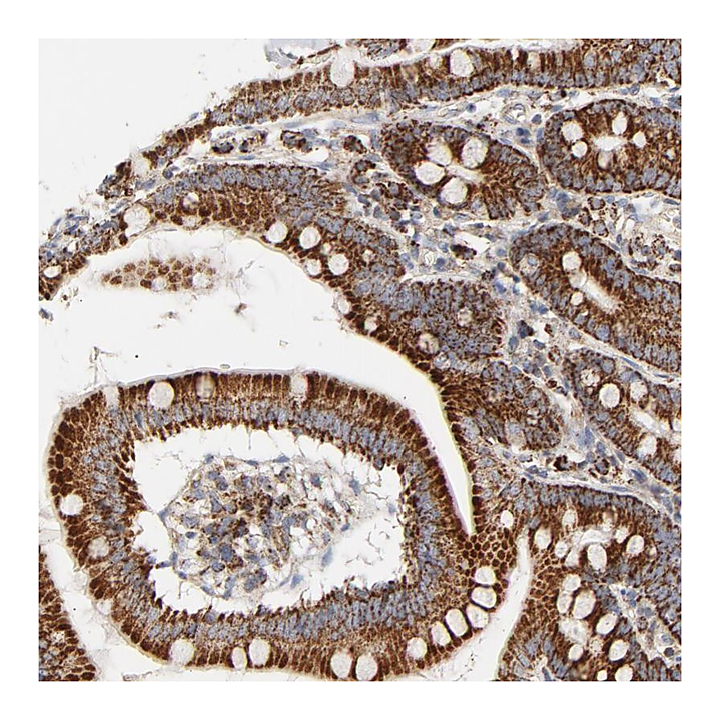 Atlas Antibodies Anti-PCNX4 Antibody
