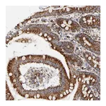Atlas Antibodies Anti-PCNX4 Antibody
