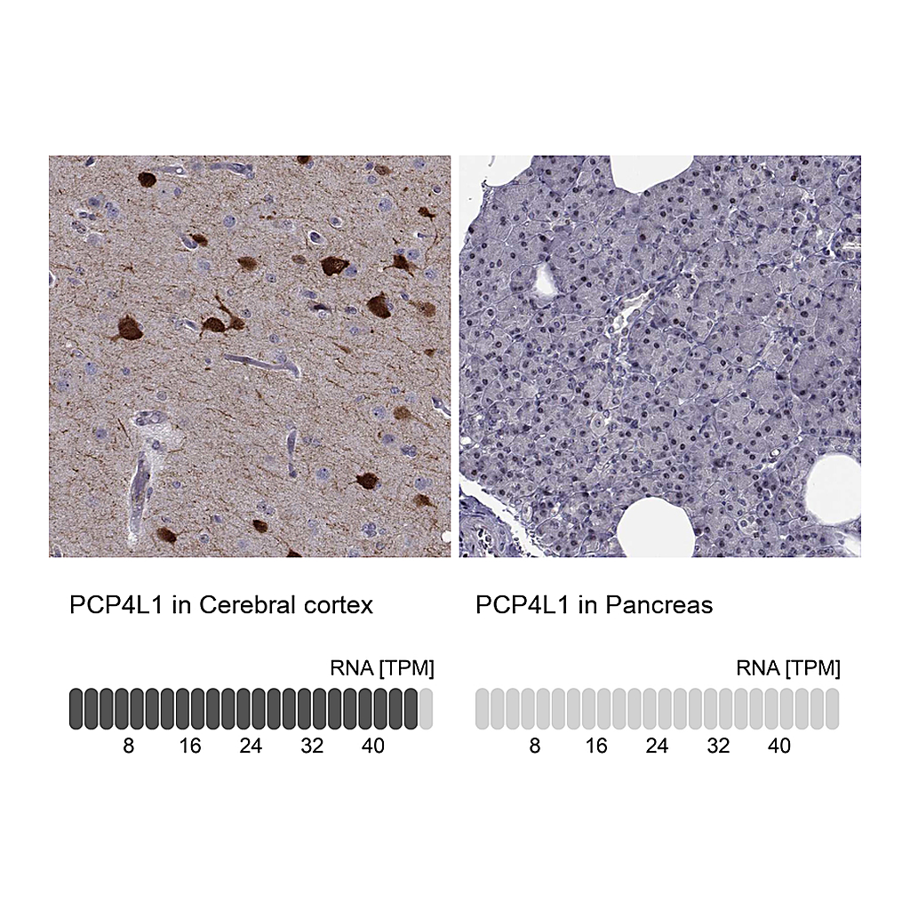 Atlas Antibodies Anti-PCP4L1 Antibody