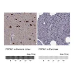 Atlas Antibodies Anti-PCP4L1 Antibody