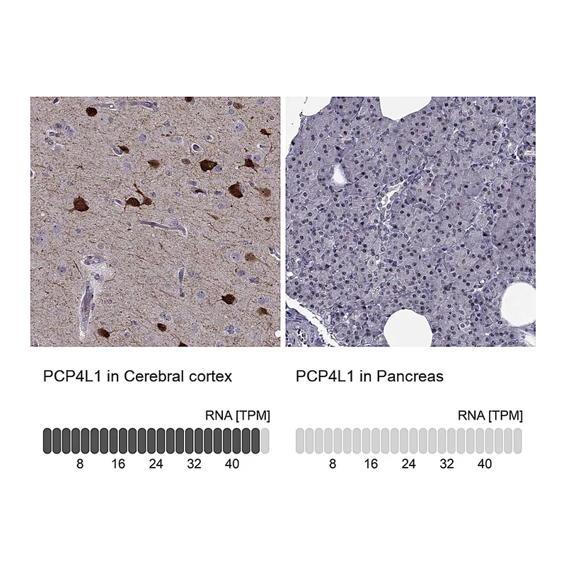 Atlas Antibodies Anti-PCP4L1 Antibody