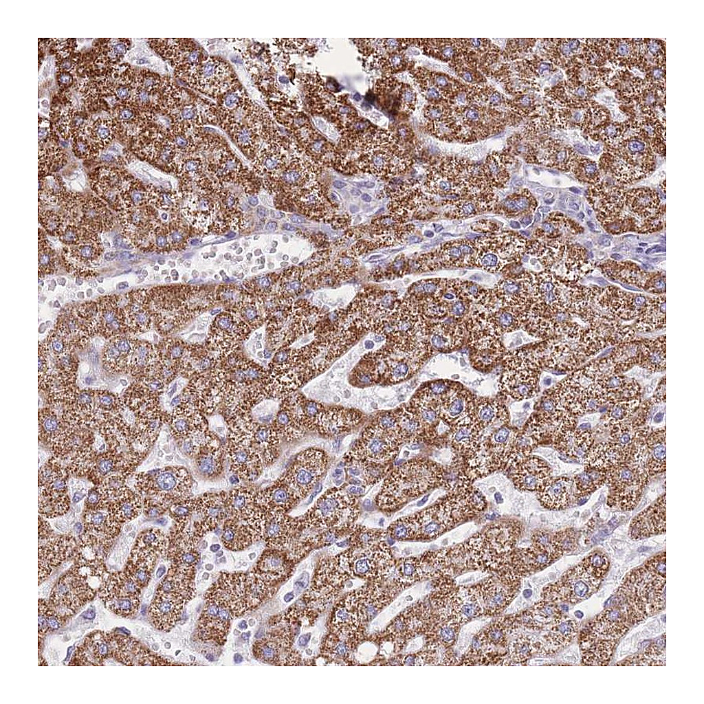 Atlas Antibodies Anti-PCSK1 Antibody