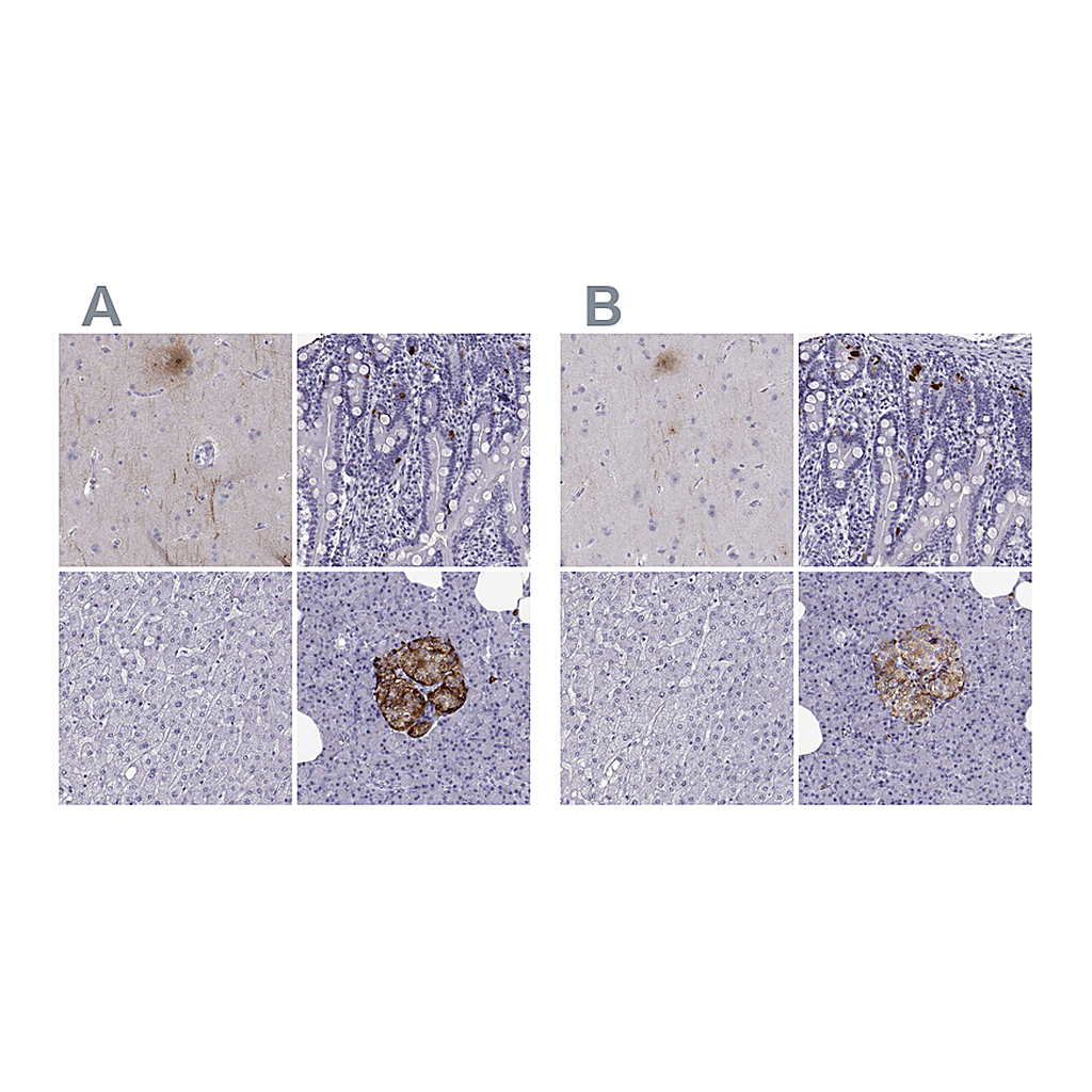 Atlas Antibodies Anti-PCSK1N Antibody