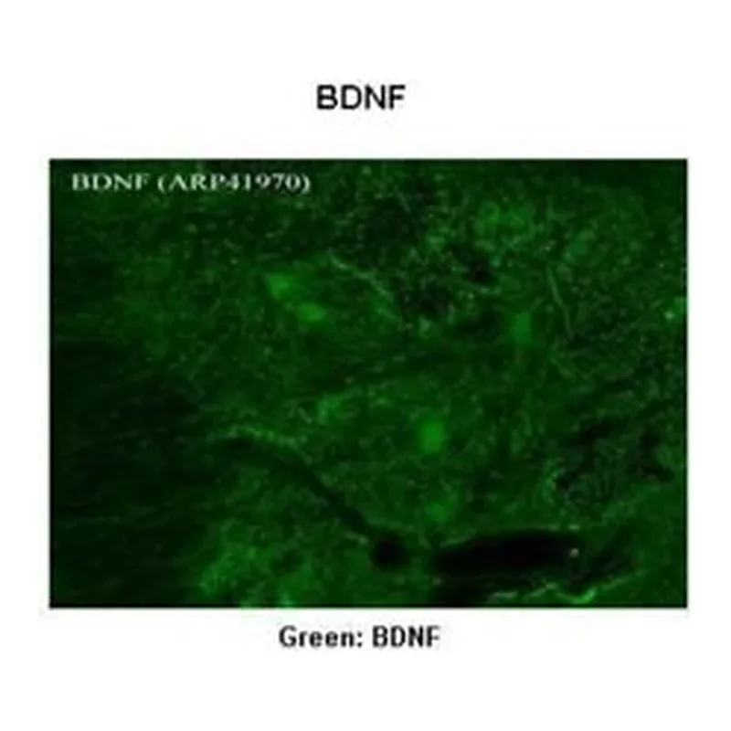 Merck ANTI-BDNF