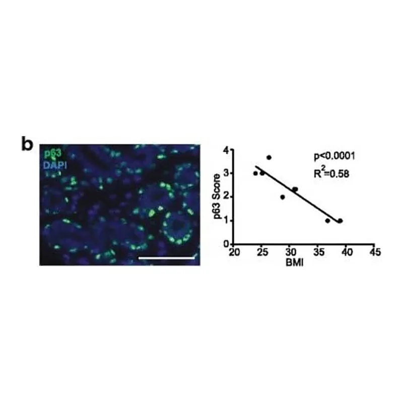 Thermo Fisher Scientific Goat anti-Rabbit IgG (H+L) Cross-Adsorbed Secondary Antibody, Alexa Fluor 546