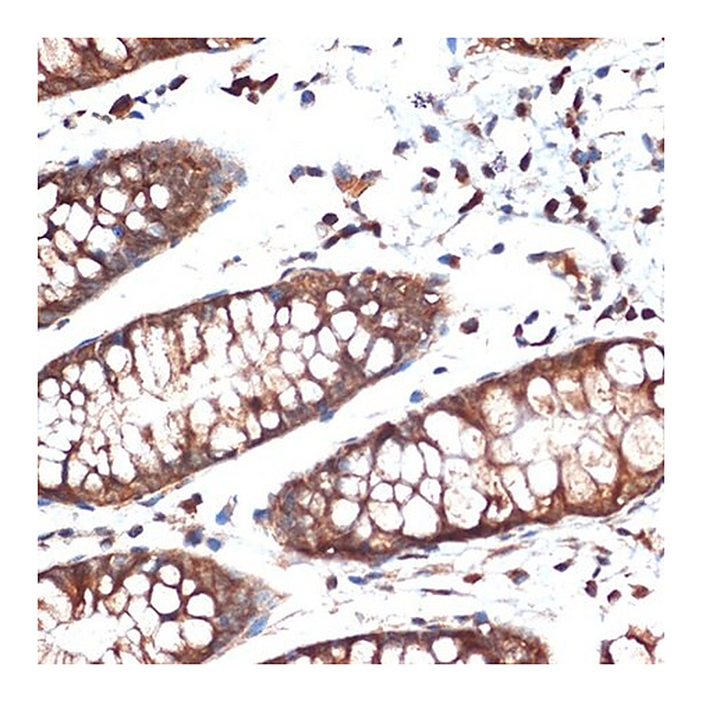 Merck Anti-STK39 antibody produced in rabbit