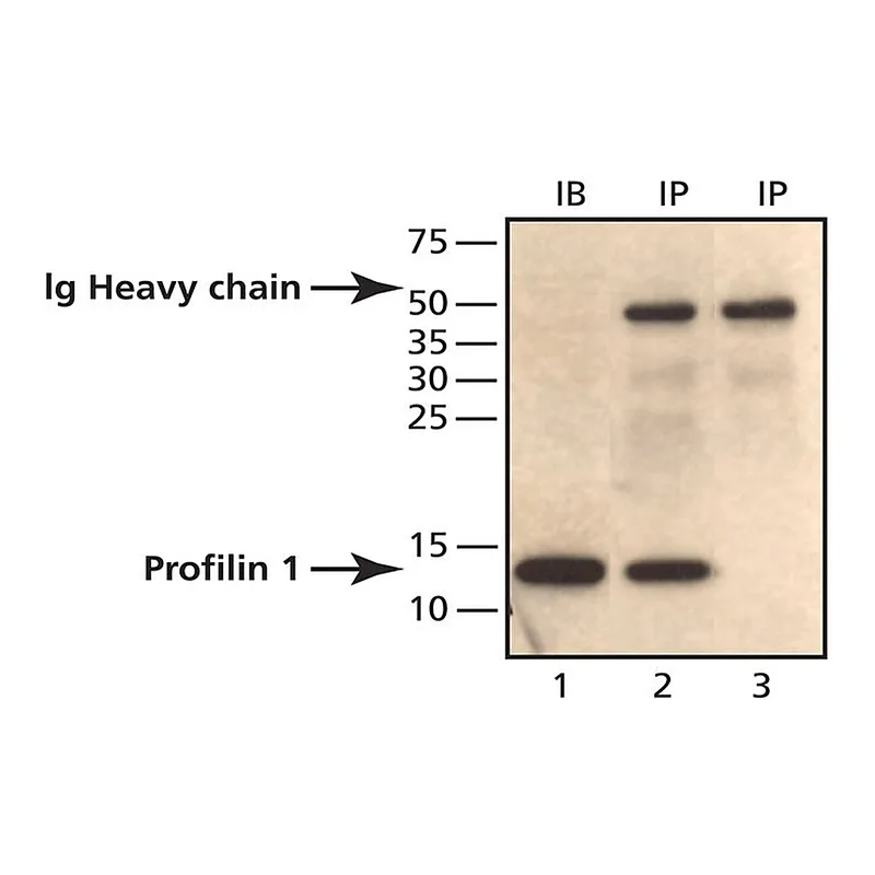 Merck Anti-Profilin 1 (C-terminal) antibody produced in rabbit