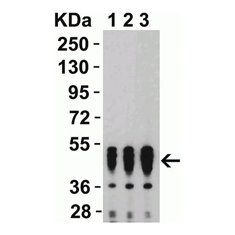 Merck Anti-SARS-CoV-2 (COVID-19) Nucleocapsid&