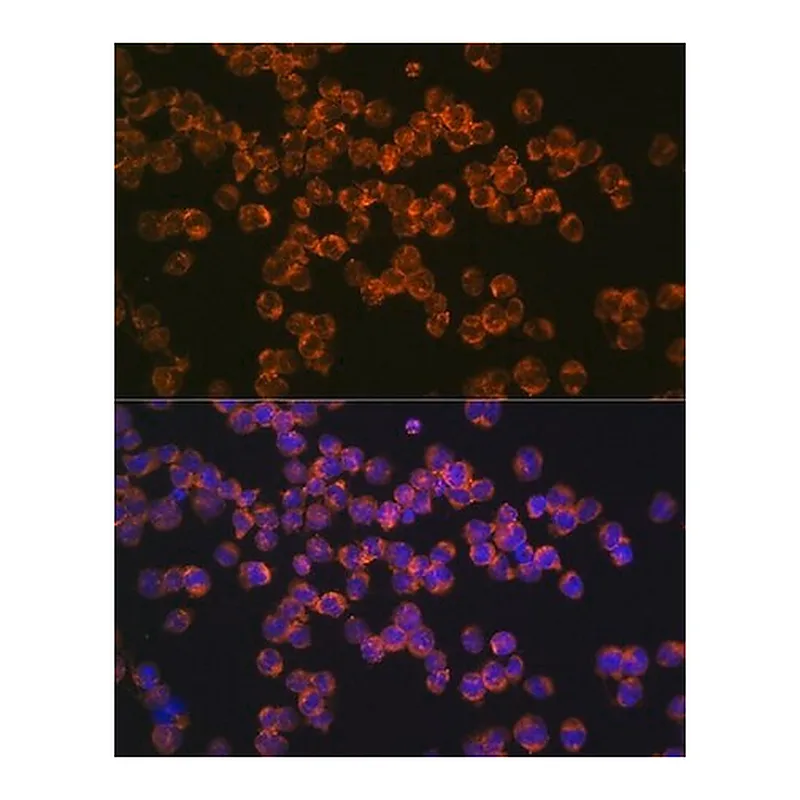 Merck Anti-CD127/IL7R antibody produced in rabbit