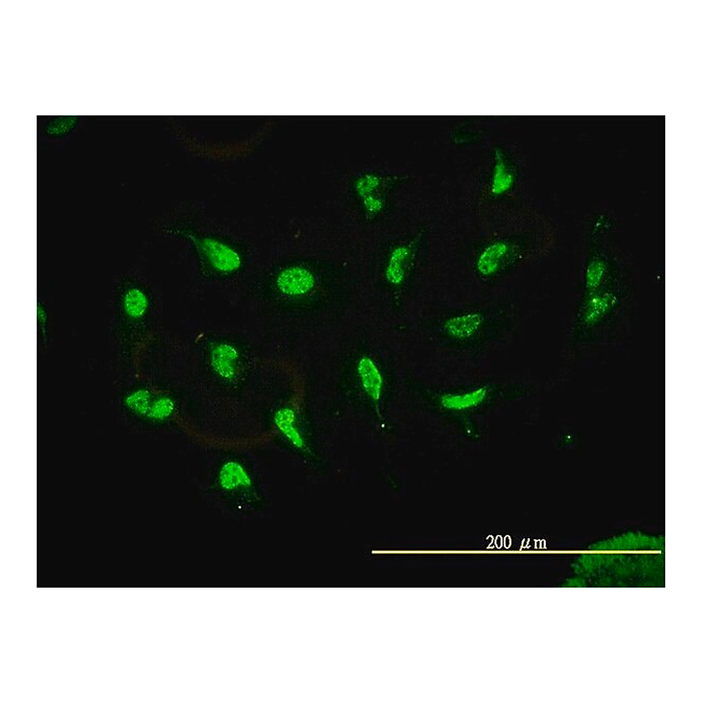 Merck Monoclonal Anti-HDAC11 antibody produced in mouse
