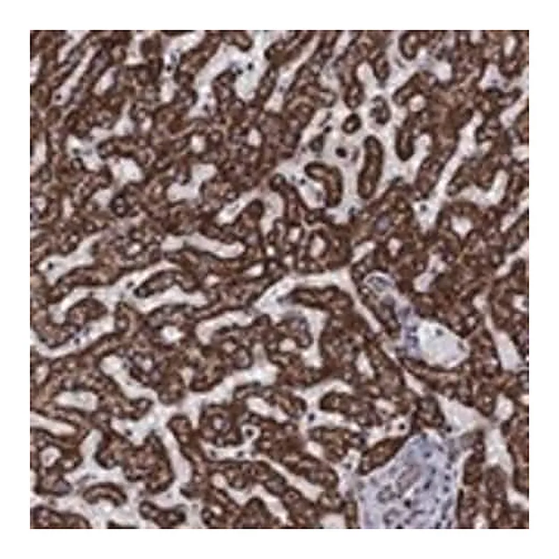 Merck Anti-ALDH1B1 antibody produced in rabbit