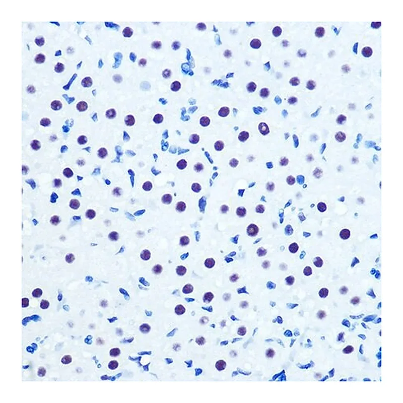 Merck Anti-CDK9 antibody produced in rabbit