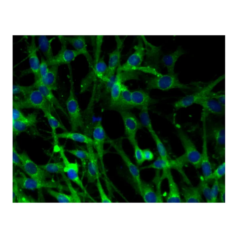 BD Purified Mouse Anti-Clathrin Heavy Chain