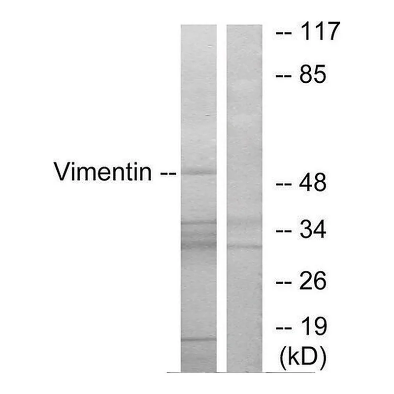 Merck Anti-Vimentin antibody produced in rabbit